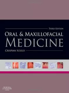 Oral and Maxillofacial Medicine: The Basis of Diagnosis and Treatment