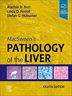 MacSween's Pathology of the Liver