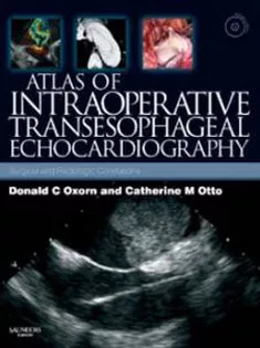 Atlas of Intraoperative Transesophageal Echocardiography