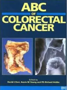 ABC of Colorectal Cancer