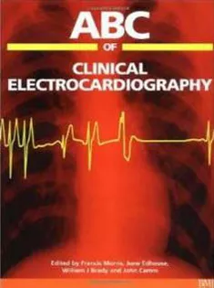 ABC of Clinical Electrocardiography