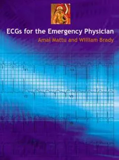 ECG's for the Emergency Physician