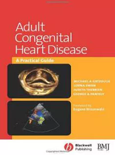 Adult Congenital Heart Disease