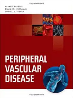 Peripheral Vascular Disease
