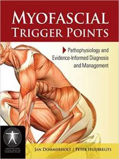 Myofascial Trigger Points
