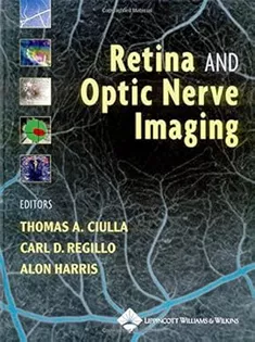 Retina and Optic Nerve Imaging