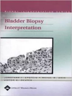 Bladder Biopsy Interpretation