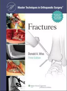 Master Techniques in Orthopaedic Surgery: Fractures