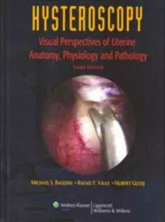 Hysteroscopy