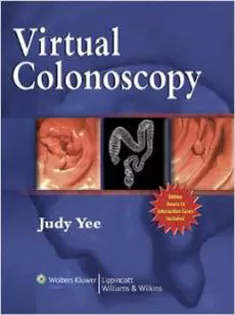 Virtual Colonoscopy