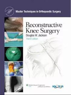 Master Techniques In Orthopedic Surgery Reconstructive Knee Surgery