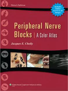 Peripheral Nerve Blocks: A Color Atlas