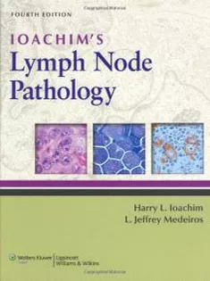 Loachim's Lymph Node Pathology