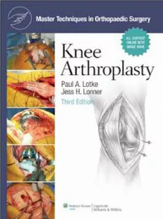Master Techniques In Orthopedic Surgery Knee Arthroplasty