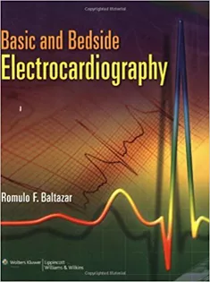 Basic And Bedside Electrocardiography