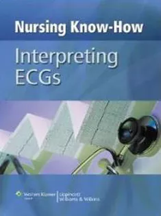 Nursing Know-How: Interpreting ECGs