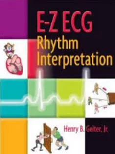 E-Z ECG Rhythm Interpretation