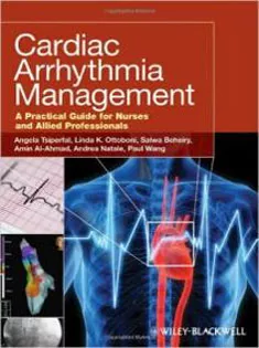 Cardiac Arrhythmia Management