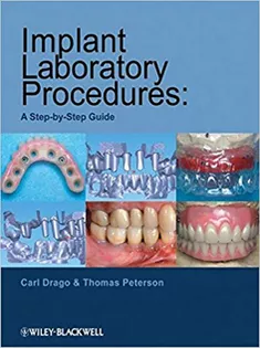 Implant Laboratory Procedures: A Step-By-Step Guide