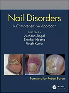 Nail Disorders: A Comprehensive Approach