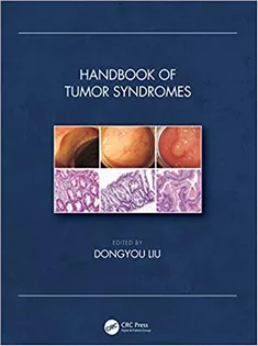 Handbook of Tumor Syndromes