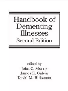 Handbook of Dementing Illnesses