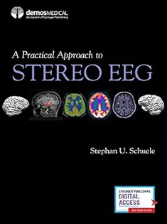 A Practical Approach to Stereo EEG