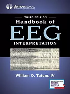 Handbook of EEG Interpretation