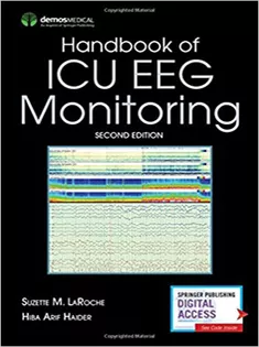 Handbook of ICU EEG Monitoring