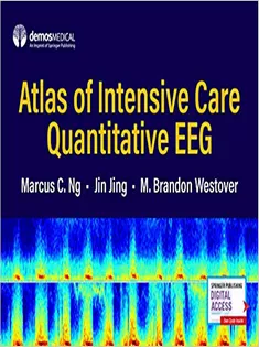 Atlas of Intensive Care Quantitative EEG