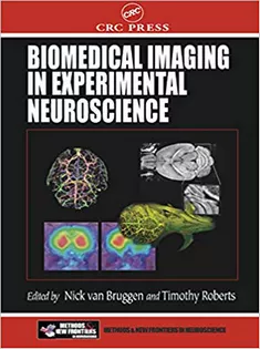 Biomedical Imaging in Experimental Neuroscience
