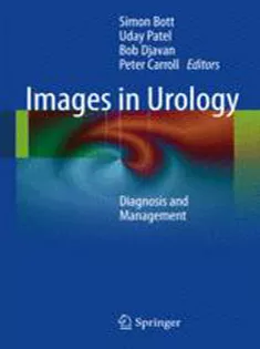Images in Urology :Diagnosis and Management