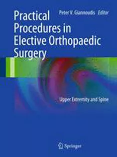 9780857298195 Practical Procedures in Elective Orthopedic Surgery: Upper Extremity and Spine