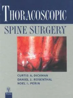 Thoracoscopic Spine Surgery