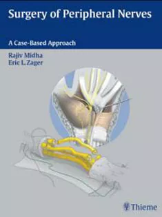 Surgery Of The Peripheral Nerves A Case - Based Approach