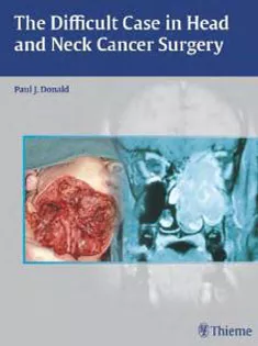 The Difficult Case In Head And Neck Cancer Surgery