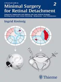 A Practical Guide to Minimal Surgery for Retinal Detachment, Vol 2