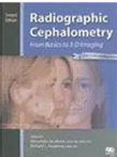 Radiographic Cephalometry: From Basics to 3-D Imaging