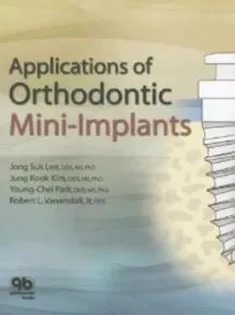 Applications of Orthodontic Mini-Implants
