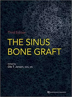 The Sinus Bone Graft
