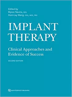 Implant Therapy: Clinical Approaches and Evidence of Success