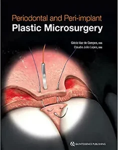 Periodontal and Peri-Implant Microsurgery