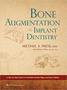 Bone Augmentation in Implant Dentistry
