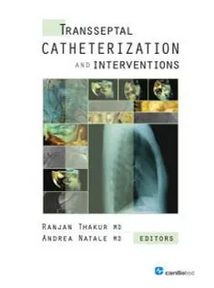 Transseptal Catheterization and Interventions
