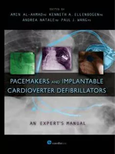 Pacemakers and Implantable Cardioverter Defibrillators