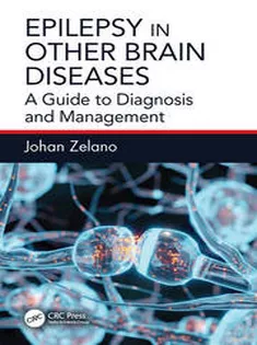 Epilepsy in Other Brain Diseases A Guide to Diagnosis and Management