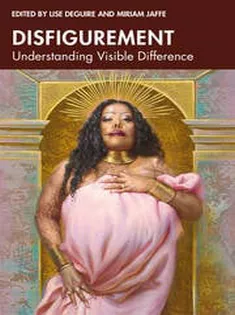 Disfigurement Understanding Visible Difference