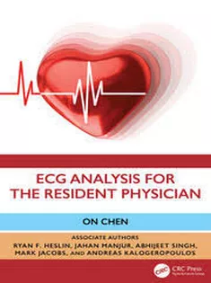ECG Companion For Beginning Experts