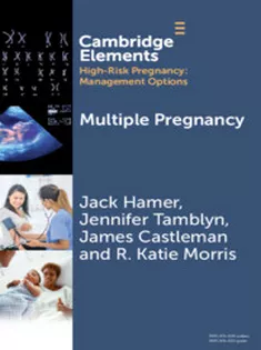 Multiple Pregnancy (Elements in High Risk Pregnancy