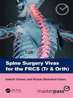 Spine Surgery Vivas for the
